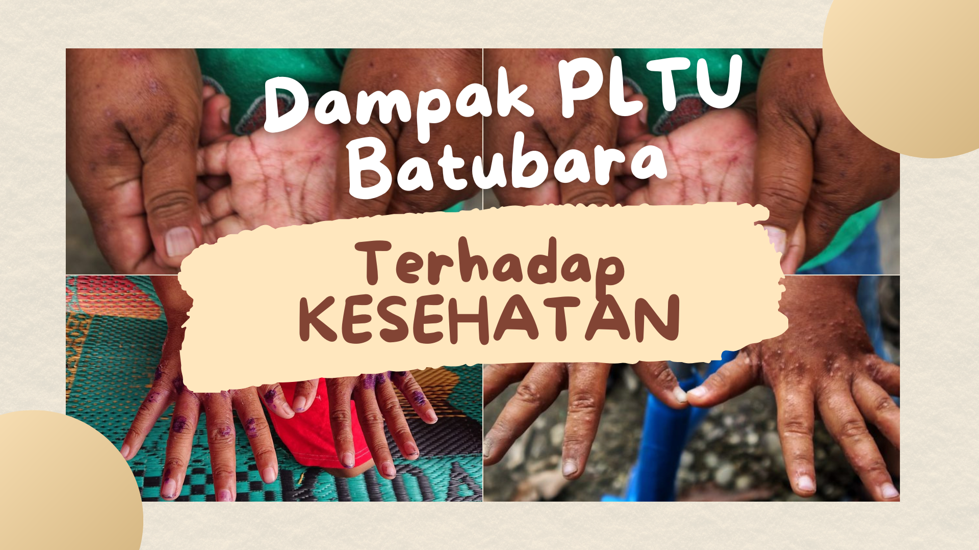 Dampak PLTU Batu Bara Pangkalan Susu Terhadap Kesehatan